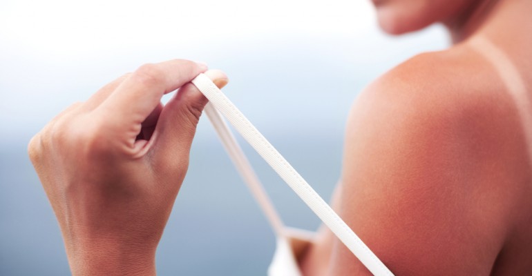 Hipolabor alerta: entenda quais são os efeitos do sol na pele