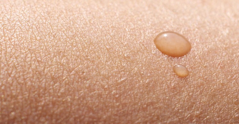 Conheça as principais causas de doenças de pele