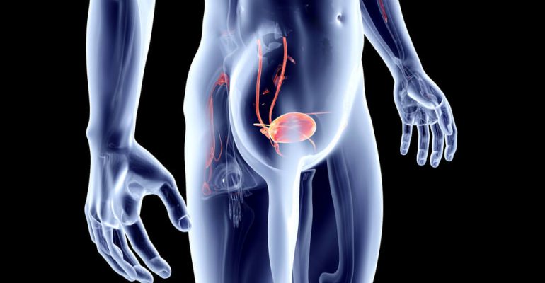 Hipolabor alerta: sintomas da cistite e como tratá-la
