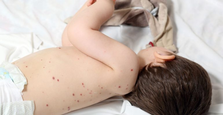 Hipolabor alerta: conheça as 5 doenças comuns em bebês